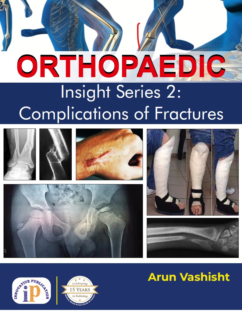 Orthopaedic Insight Series 2: Complications of Fractures - IP Innovative