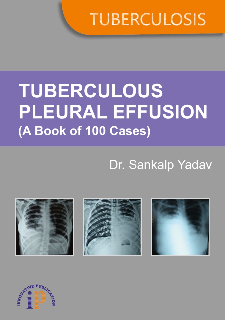 Tuberculous Pleural Effusion (A Book of 100 Cases) - Infectious diseases