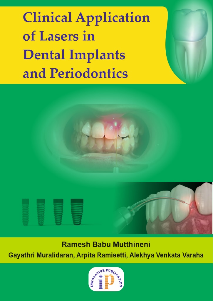 Clinical Application of Lasers in Dental Implants and Periodontics - Implantology