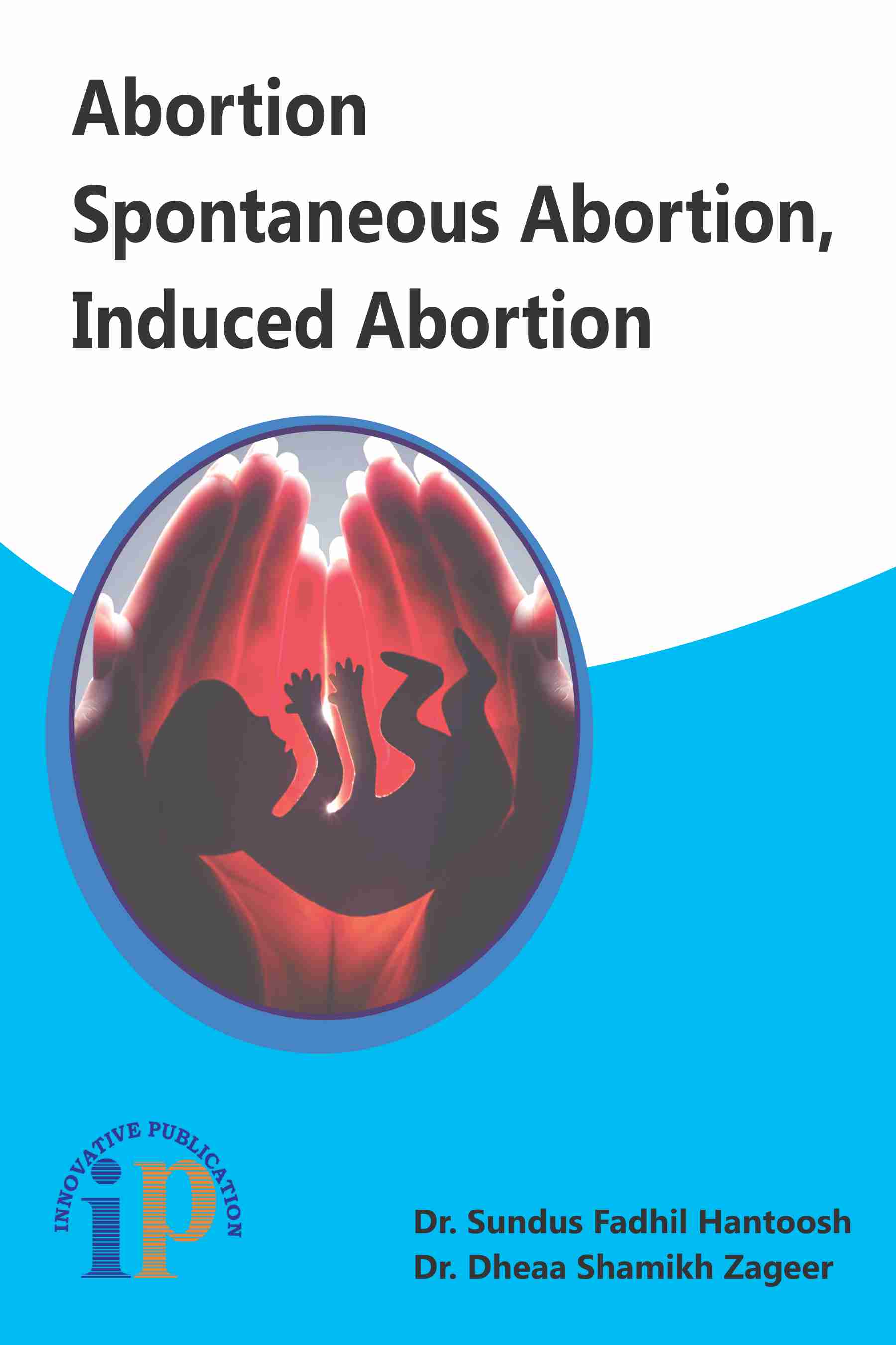 Abortion Spontaneous Abortion, Induced Abortion - Gynaecology and midwifery