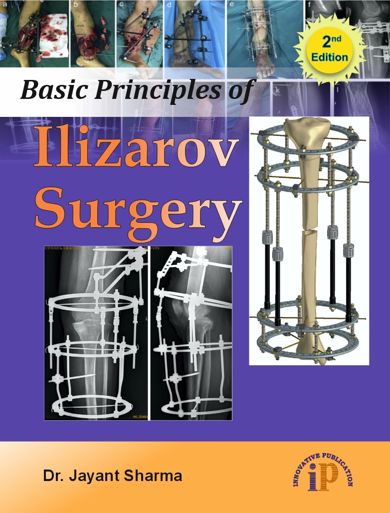Basic Principles of Ilizarov Surgery (2e)