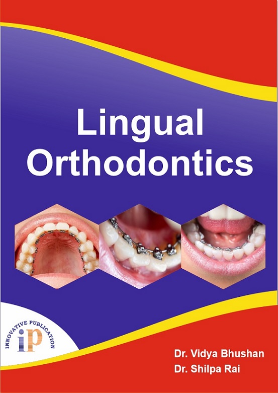 Lingual Orthodontics