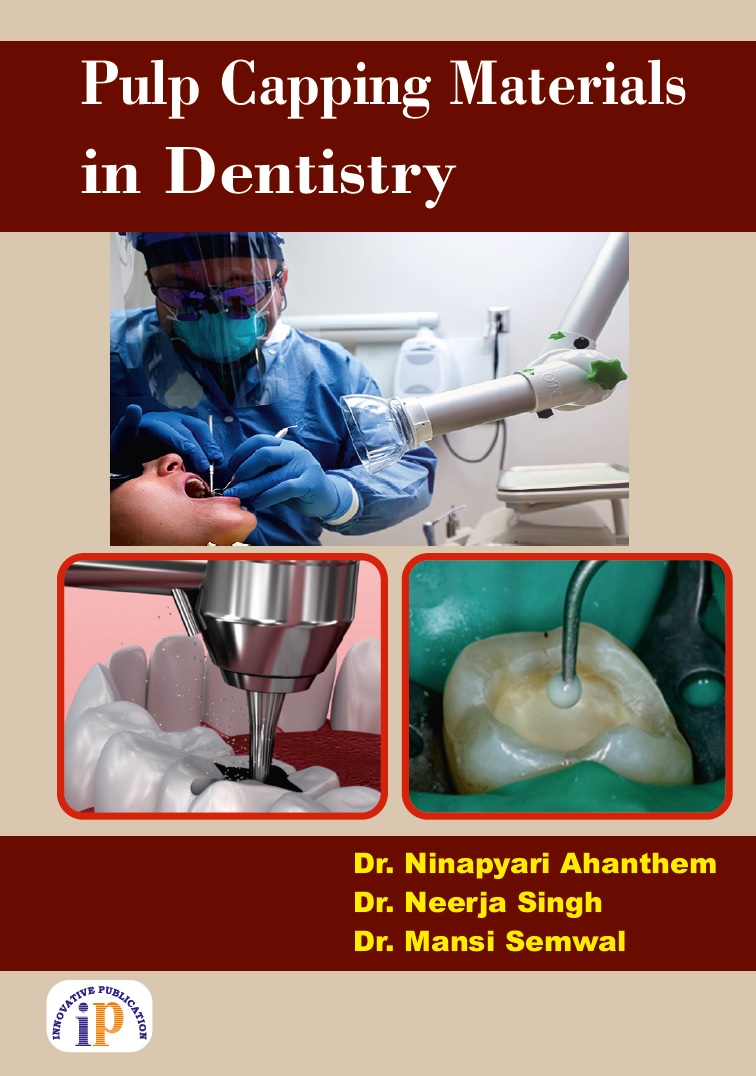 Pulp Capping Materials in Dentistry