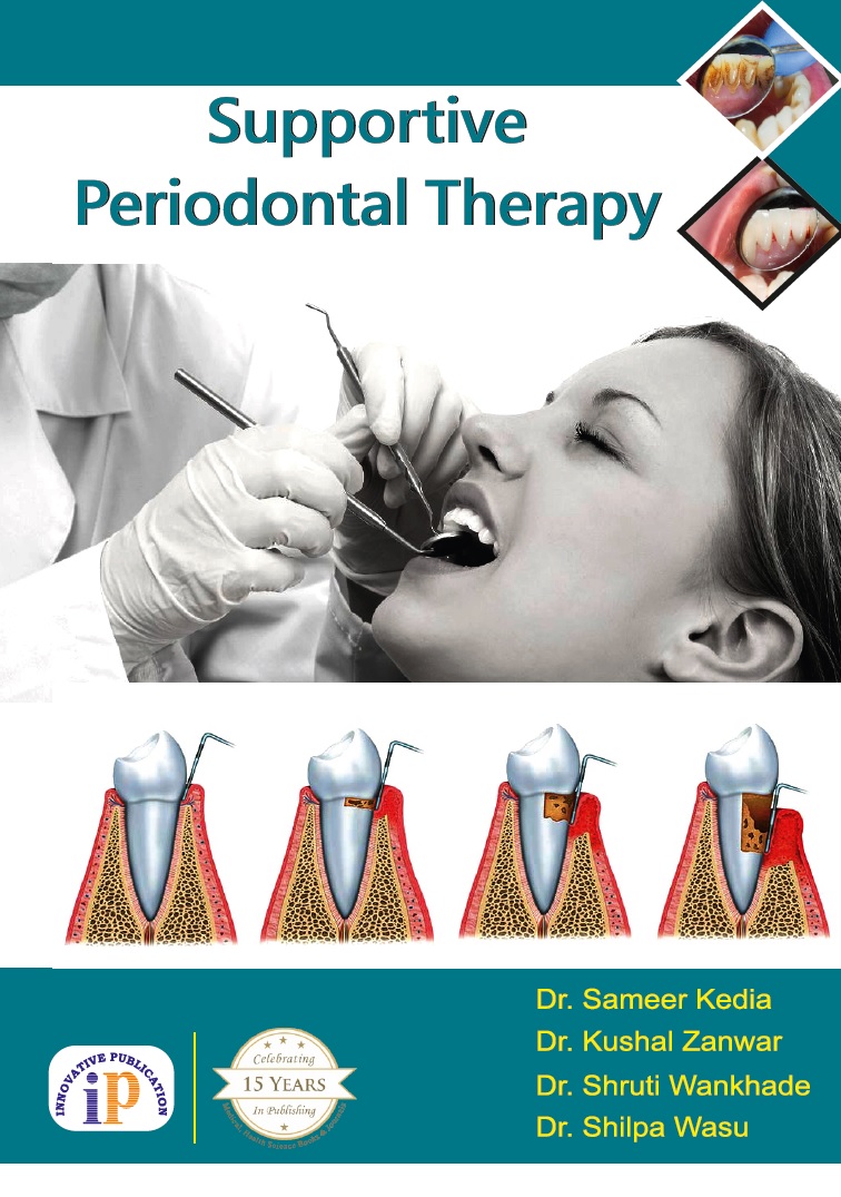 Supportive Periodontal Therapy