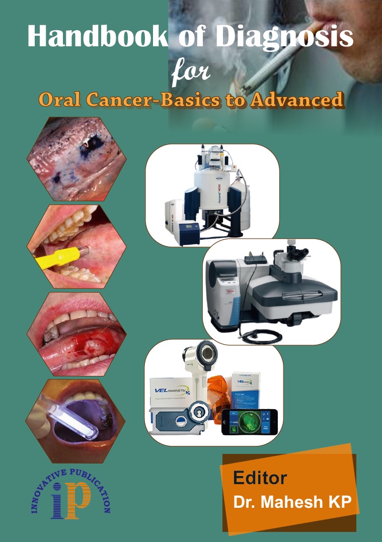Handbook of Diagnosis for Oral Cancer-Basics to Advanced